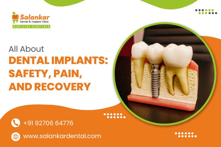 All About Dental Implants: Safety, Pain, and Recovery