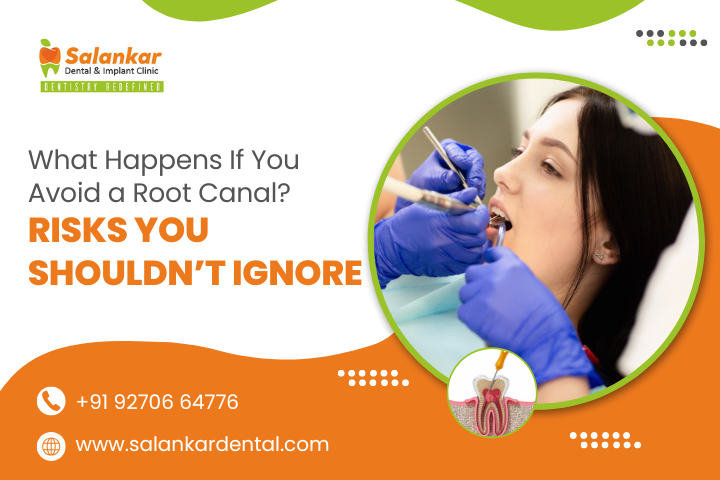 What Happens If You Avoid a Root Canal? Risks You Shouldn’t Ignore