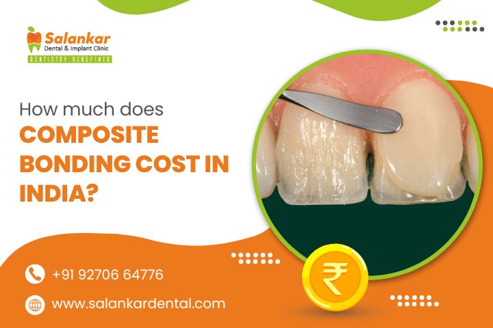 How Much Does Composite Bonding Cost in India?