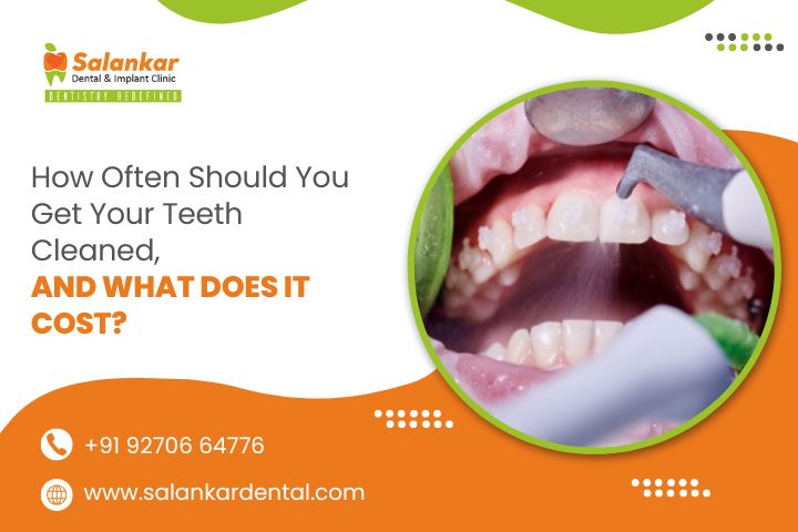 How Often Should You Get Your Teeth Cleaned, and What Does It Cost?