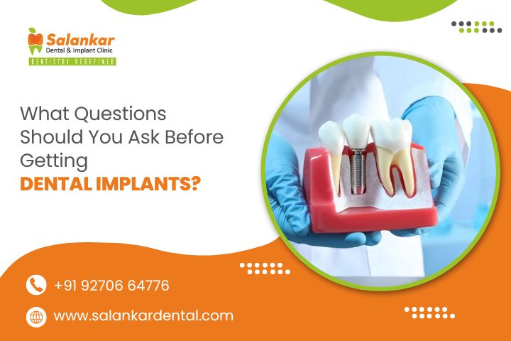 What Questions Should You Ask Before Getting Dental Implants?